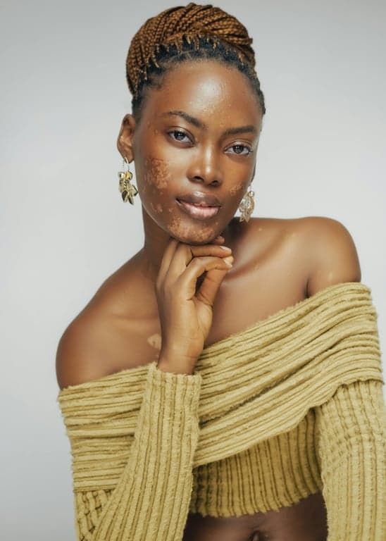 AI blemish remover before photo - studio shot showing facial imperfections